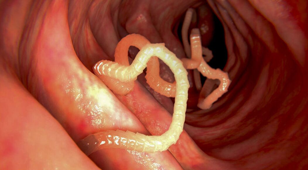 diagnóstico de parásitos en los intestinos