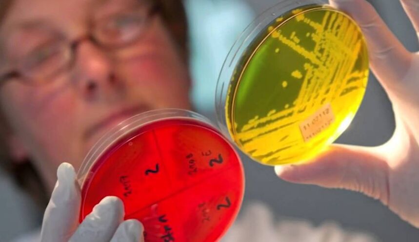Diagnóstico de parásitos en el cuerpo humano