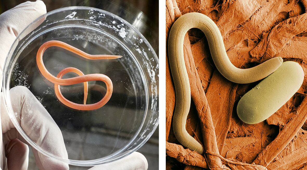 parásitos en el cuerpo humano