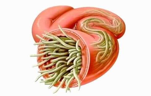 Los gusanos son parásitos en el intestino humano.
