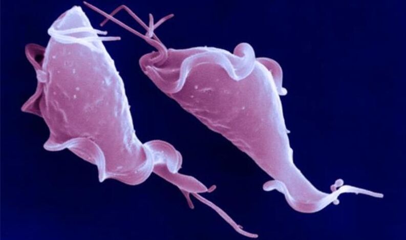 Trichomonas vaginalis es un parásito protozoario que causa infertilidad.